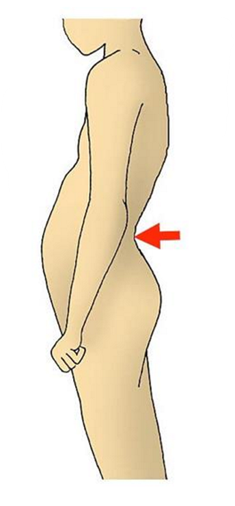 <p>What does the following image display an example of, & how might this occur?</p>
