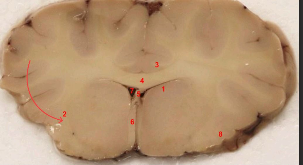 <p>what capsule is this </p>