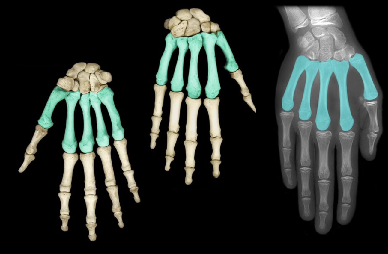 <p>What structure is highlighted?</p>