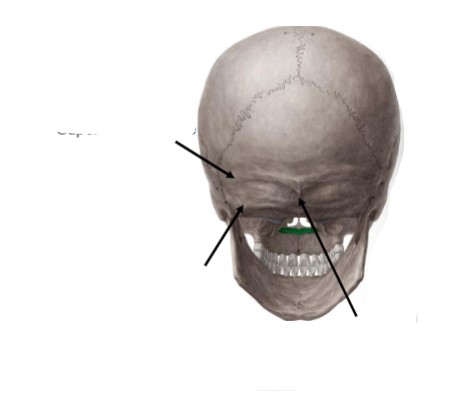 <p>What do the 3 arrows point to </p>