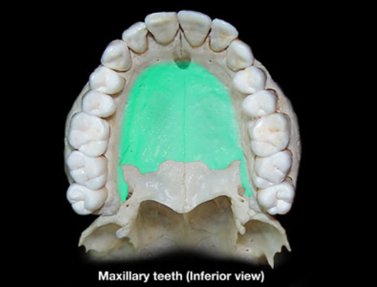 term image