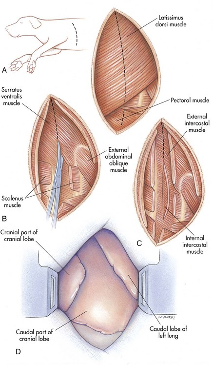 <p>Lateral thoracotomy</p>
