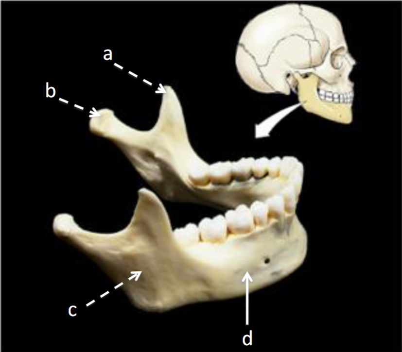 <p>B</p>