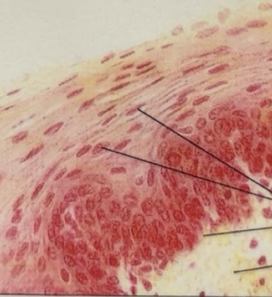 <p>stratified squamous epithelium </p>