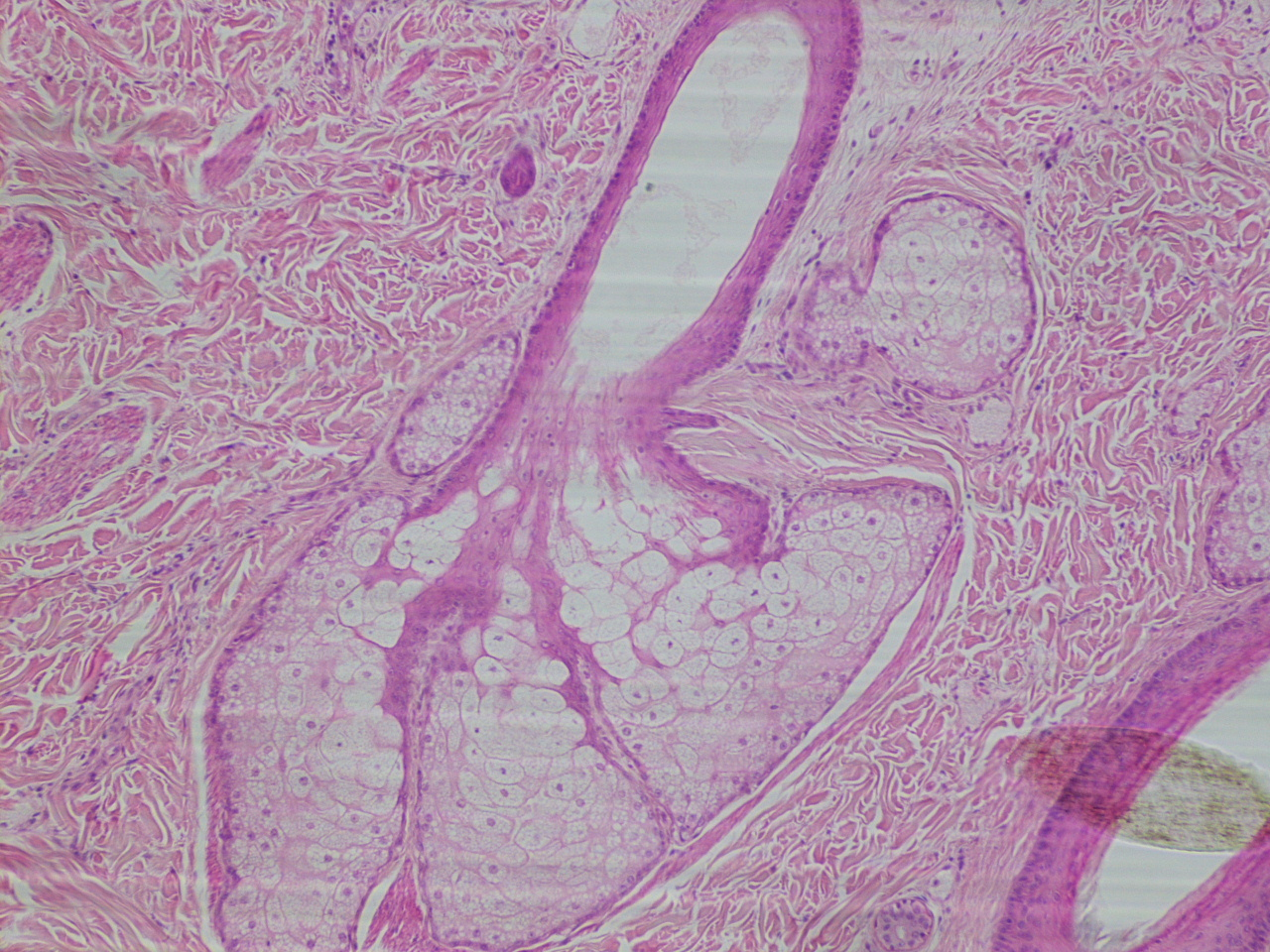 term image