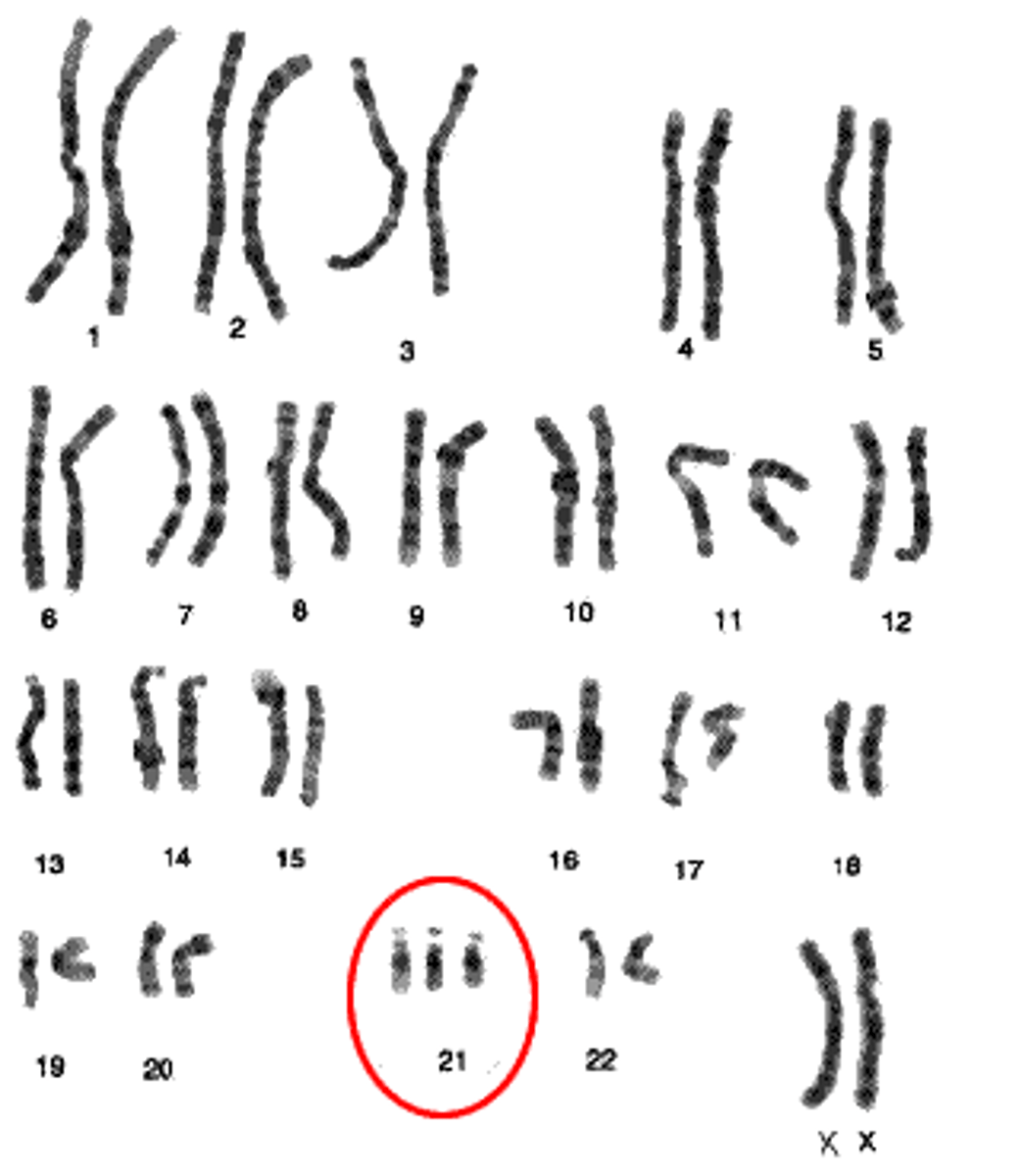 <p>Extra or missing chromosomes.</p>