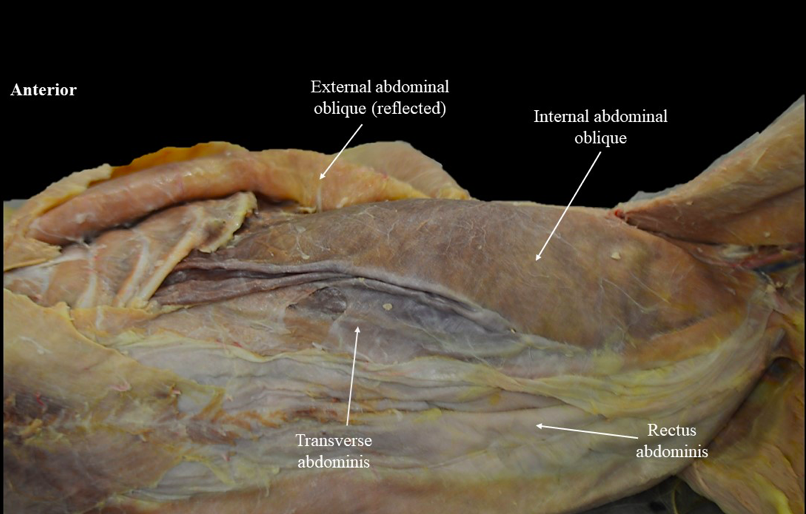 <p>What is the name of this muscle? (NO LAB IMAGE - T.A)</p>