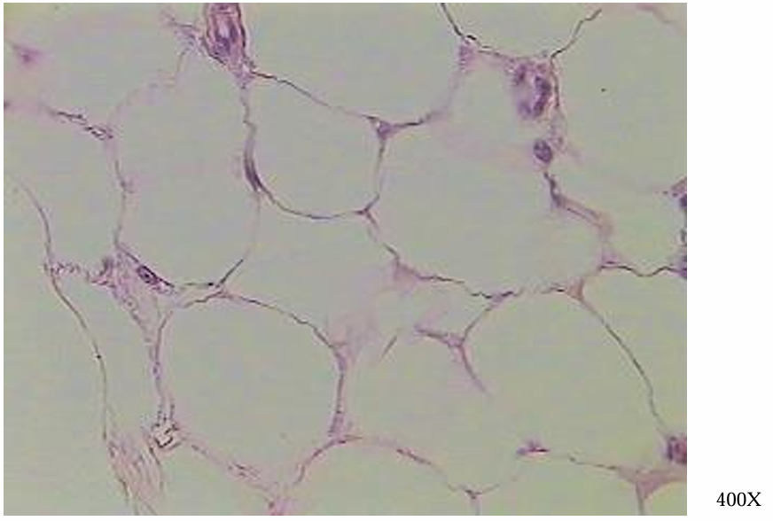 <p>what is this tissue</p>