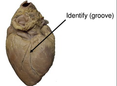 <p>Identify the structure</p>
