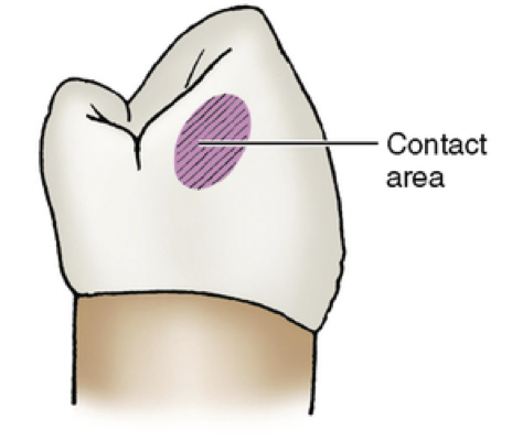 <p>The area of the mesial or distal surfaces of a tooth that touches its neighbor in the arch</p>