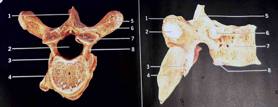 <p>ID vertebra (what type) </p>
