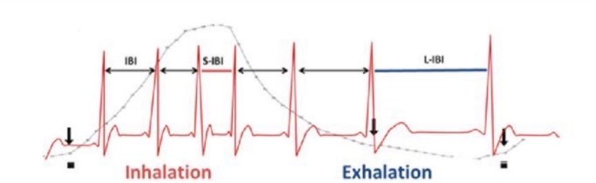 <p>Regularly irregular </p>