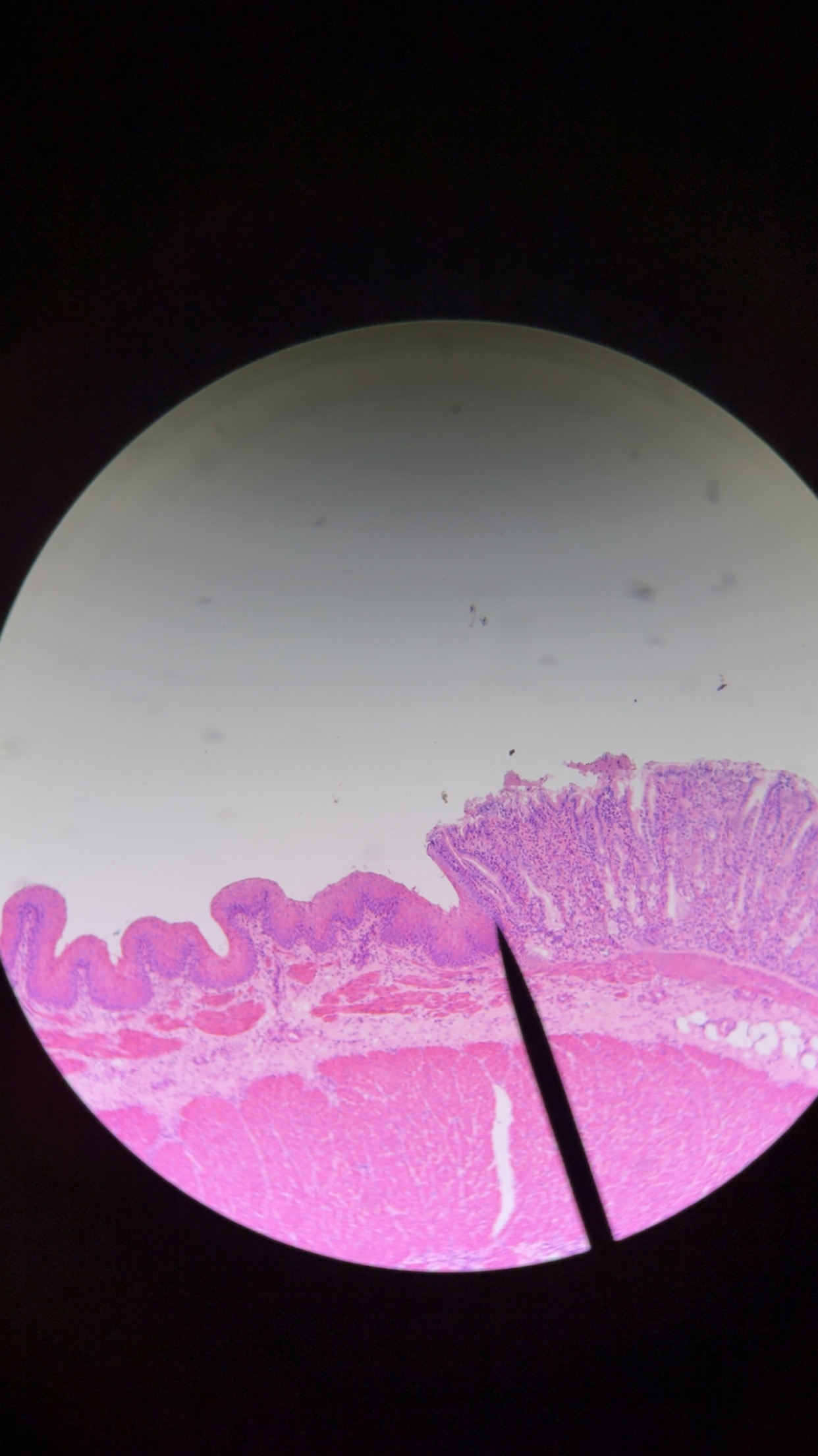 <p>cardiac stomach - 3 </p>