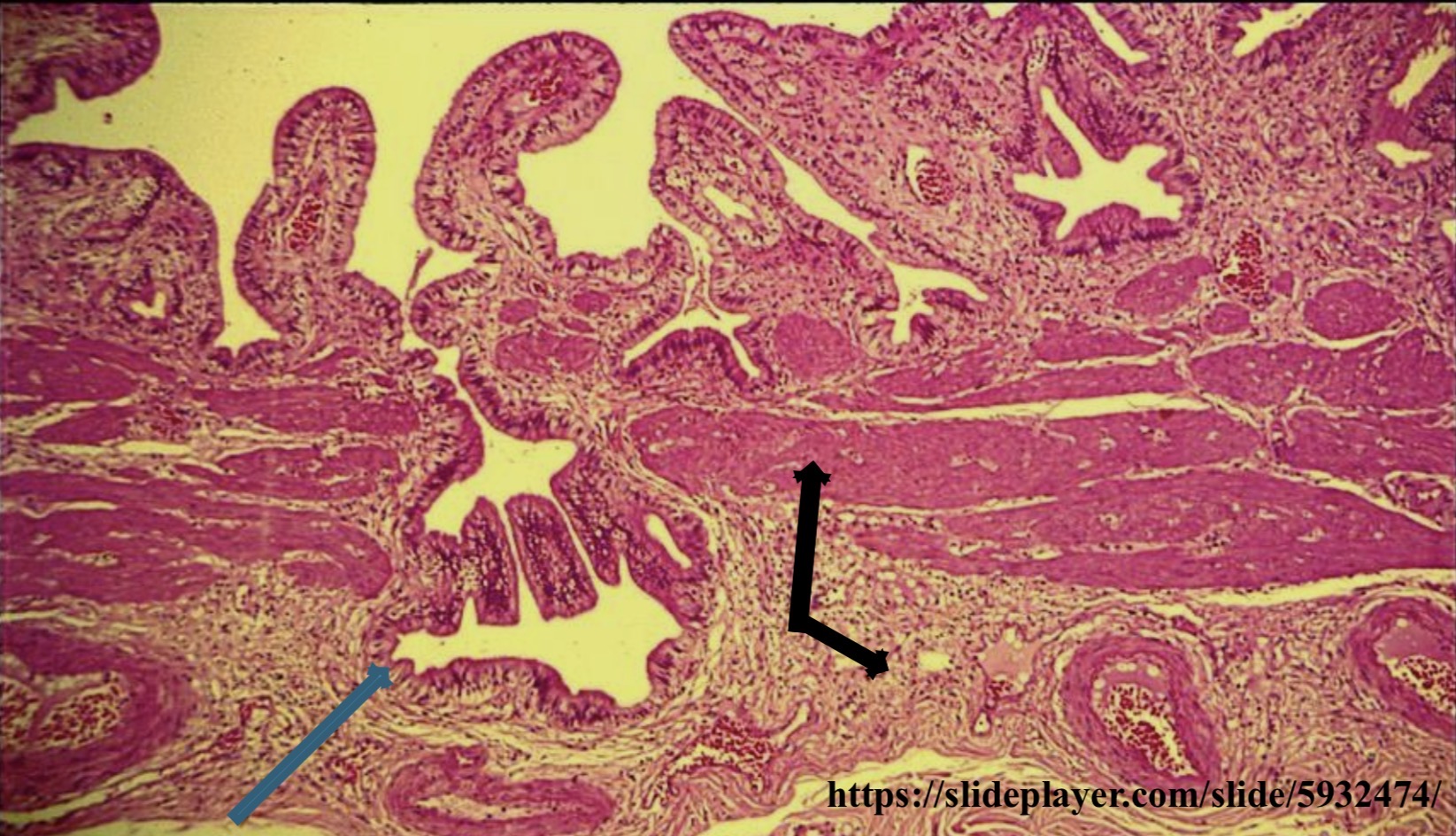term image