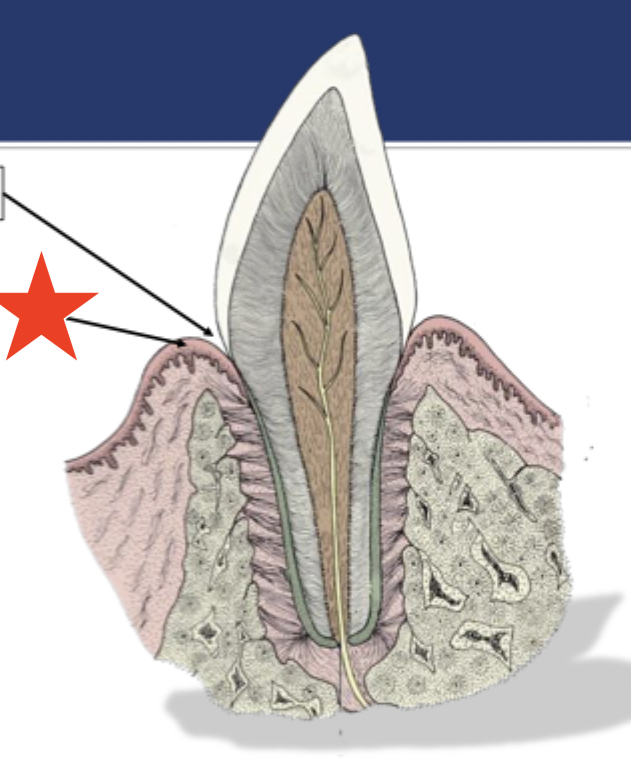<p>What part of the tooth is indicated by the star?</p>