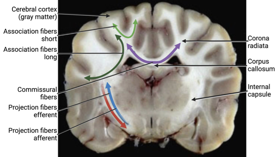 <p><strong>Neuronal cell bodies</strong> (somata)</p>