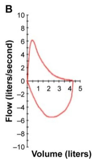 <p>Explain what is occurring in the Flow-volume loop</p>