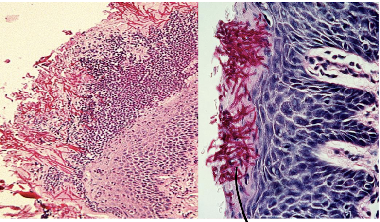 <p>Disease</p>