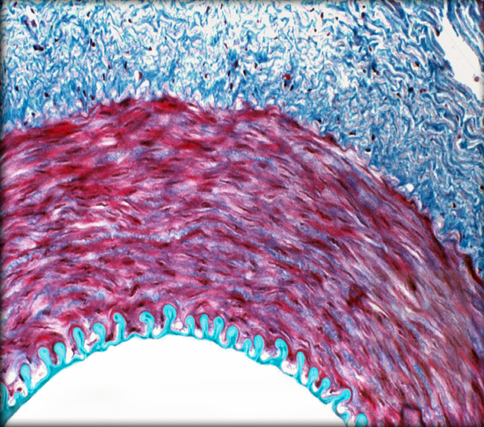 <ul><li><p><strong>Location: </strong>Innermost layer of vessel wall</p></li><li><p><strong>Function:</strong></p><ul><li><p>Selectively permeable barrier to blood solutes</p></li><li><p>Secretes vasoconstrictors and vasodilators</p></li><li><p>Provides smooth inner lining that repels blood cells and platelets</p></li></ul></li><li><p><strong>Description:</strong></p><ul><li><p>Endothelium, its basement membrane, elastic laminae and elastic fibers</p></li><li><p>External limit formed by internal elastic lamina (not clearly defined)</p></li></ul></li></ul><p></p>