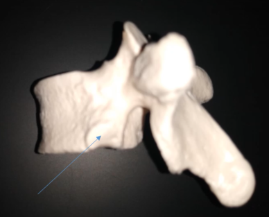<p>Which vertebrae is this?</p>