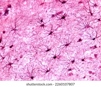 <p>Identify the tissue </p>