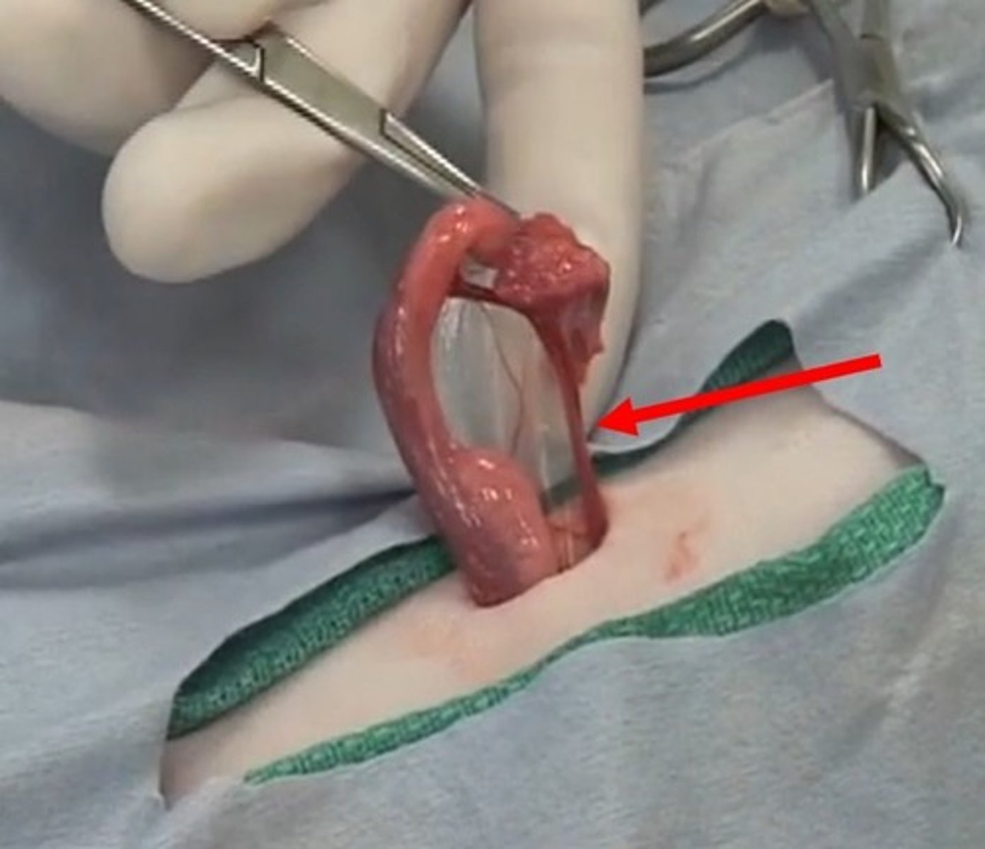 <p>the pedicle ligament</p>