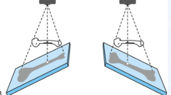 <p><span>How can this type of distortion be prevented?</span></p>