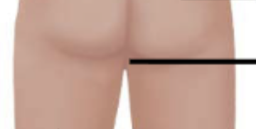 <p>Area between external genitalia and anus. </p>