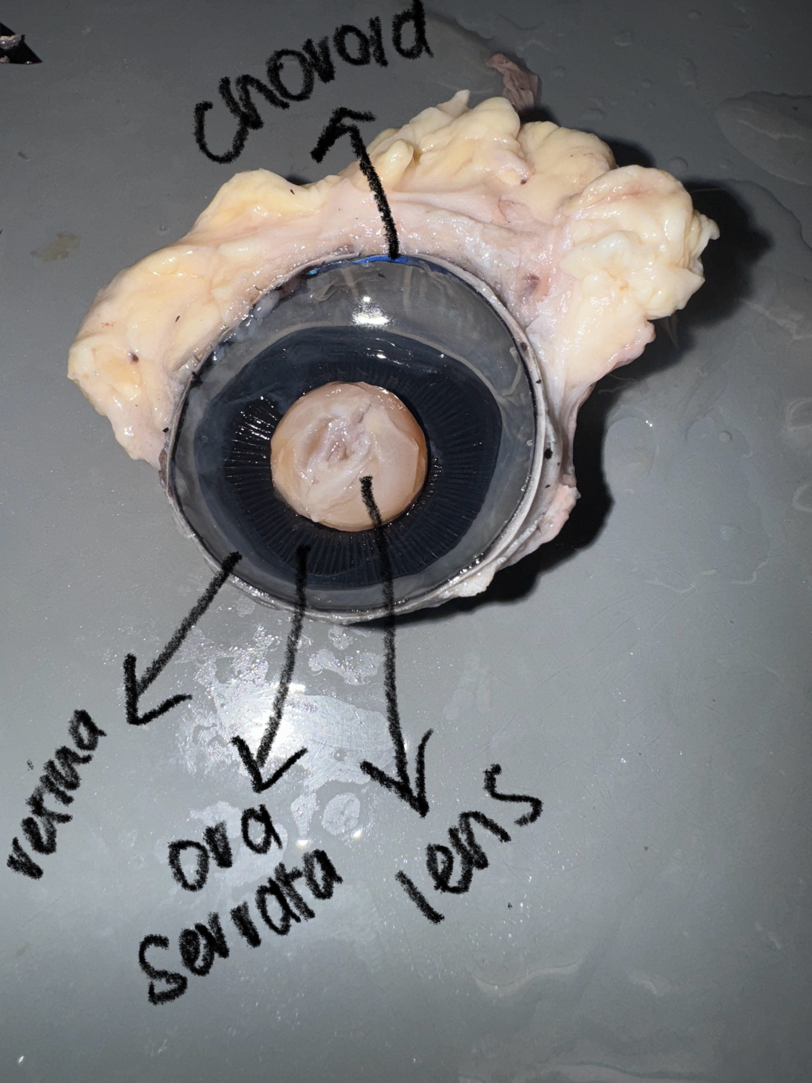 <p>-iris: the layer between the cornea and the lens </p><p>-pupil: is the colored part of the eye*opening in the iris </p><p>-Lens: transparent structure behind the iris </p>