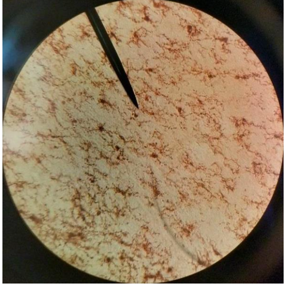 <p>Tinción histoquímica</p>