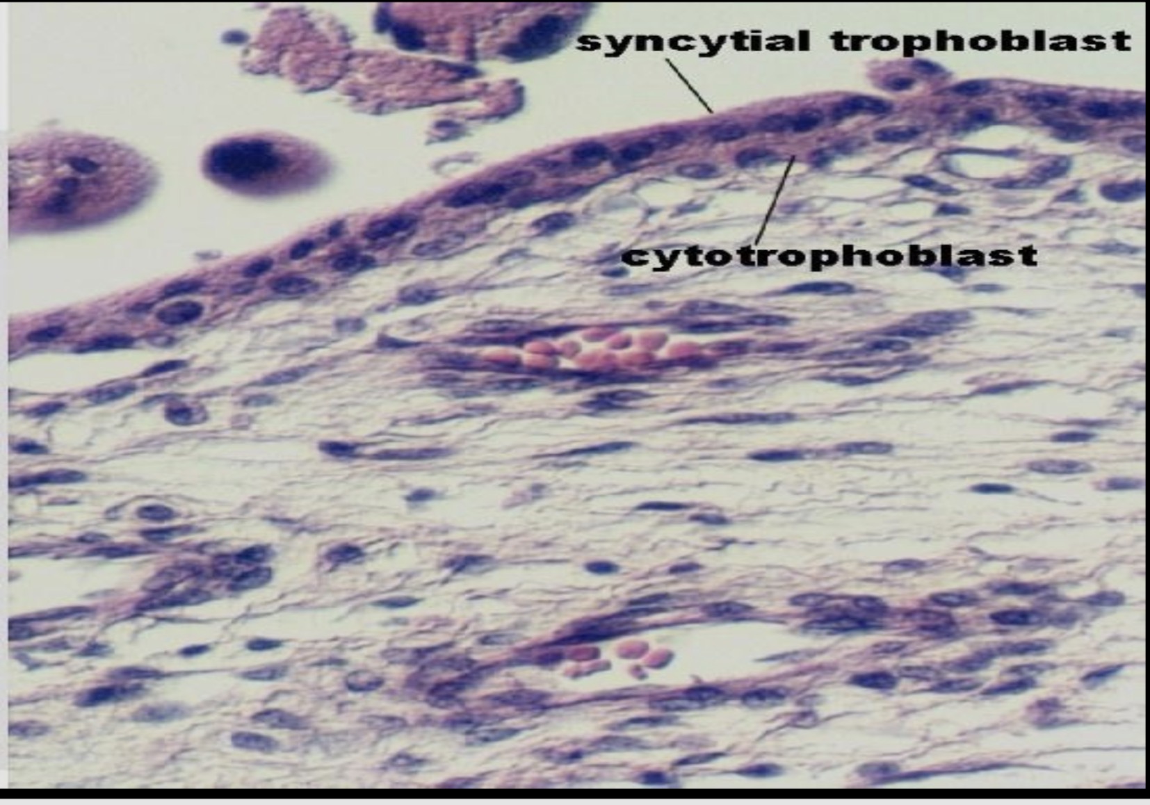 term image