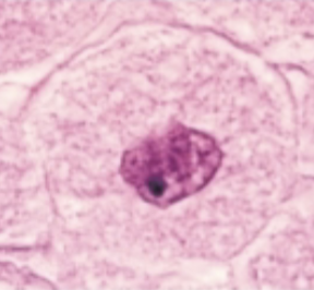 <p>what phase of the cell cycle is this?</p>