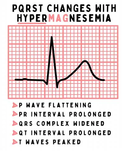 <p>Identify the electrolyte imbalance based on the ECG: </p><ul><li><p>Prolonged PR interval</p></li><li><p>Widened QRS complex</p></li></ul><p></p>