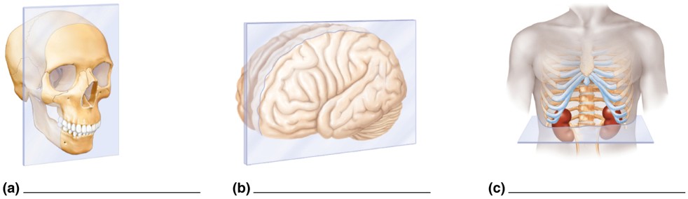 <p>What are the cross sections?</p>