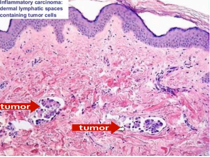 <p>What pathology?</p>