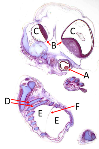 <p>Label A, B, C, D, E and F</p>