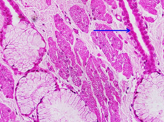 <p>Biểu mô gì ?</p>