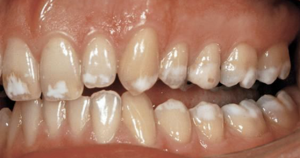 <p>what type of AI</p>