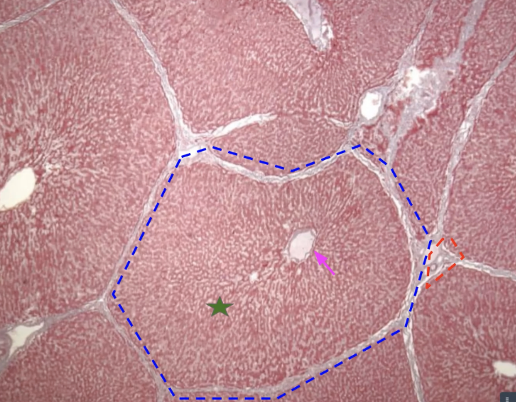 <p>what is this? what is in blue </p>