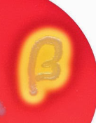 <p>What does beta hemolysis on Blood Agar indicate?</p>