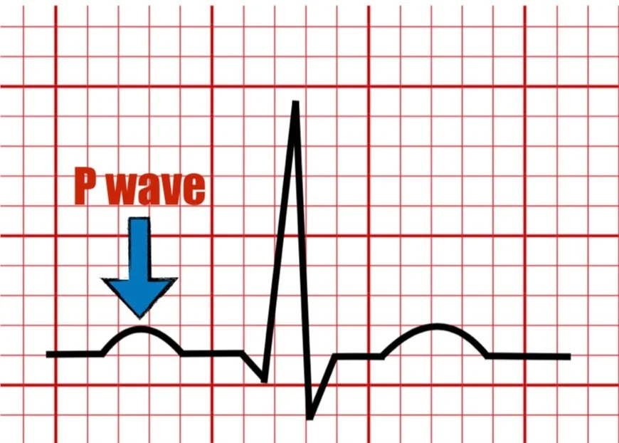 <p>first interval</p><p>Atrial depolarization</p>