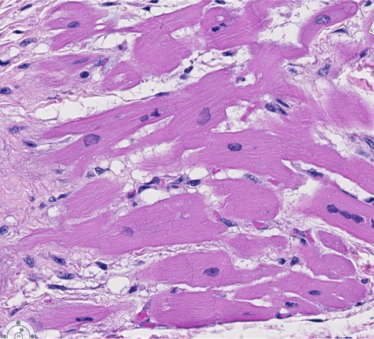 <p><span style="font-family: "Calibri Light";">This image illustrates some of the key features of cardiac muscle. <br><br>Which key features can you identify in these longitudinally arranged cardiac myofibers?</span></p>