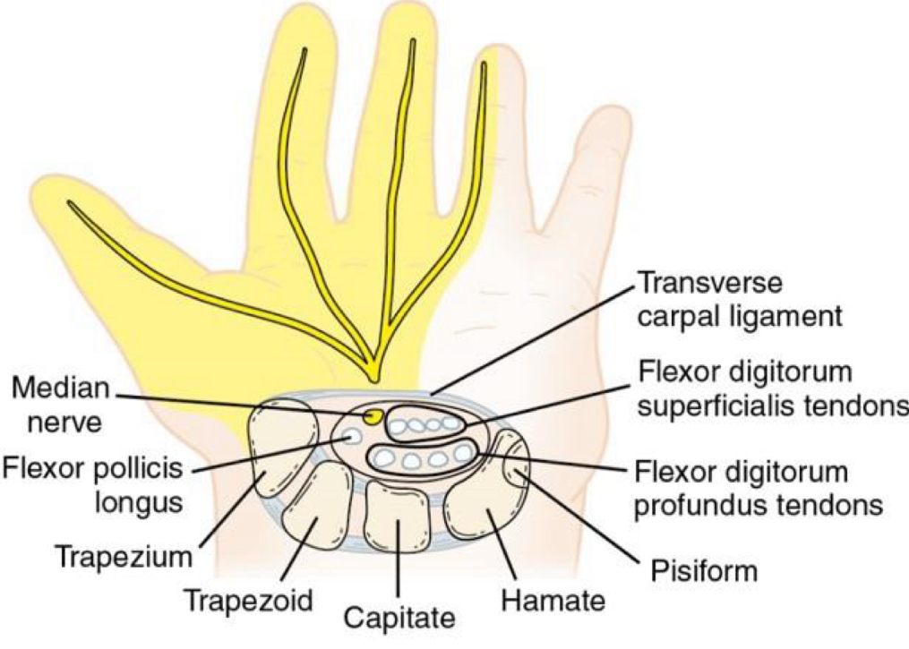 <ul><li><p>carpal bones form a medial/lateral arch with palmar concavity</p></li><li><p>this arch connects by the palmar and transverse carpal ligaments</p><ul><li><p>forming a tunnel through which external finger flexor tendons and the median nerve pass</p></li></ul></li><li><p>enclosed space</p><ul><li><p>compression of median nerve</p></li></ul></li></ul><p></p>