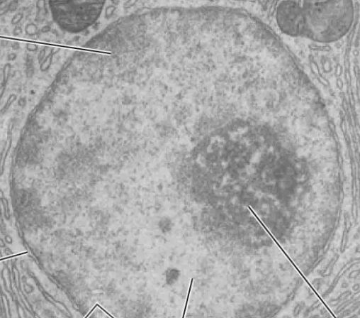 <p>Appears as a dense, membrane-bound spherical structure filled with dark patches of inactive heterochromatin and lighter regions of active euchromatin</p>