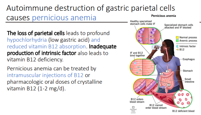 <ol><li><p>Intramuscular injections of B12 </p></li><li><p>Pharmacologic oral doses of crystalline vitamin B12 (1-2 mg/d)</p></li></ol><p></p>