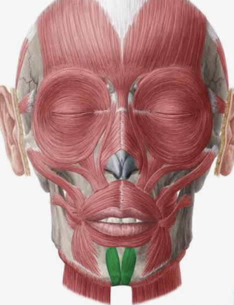 <p>Which muscle is this?</p>