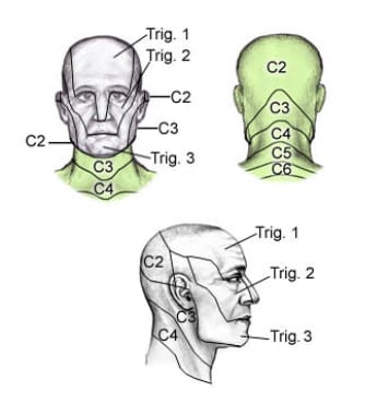 <p>Dermatome C2</p>
