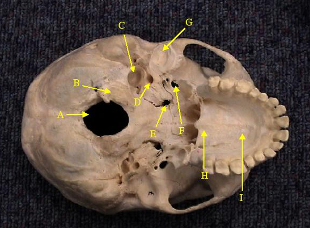 <p>Identify the opening labelled F. </p>