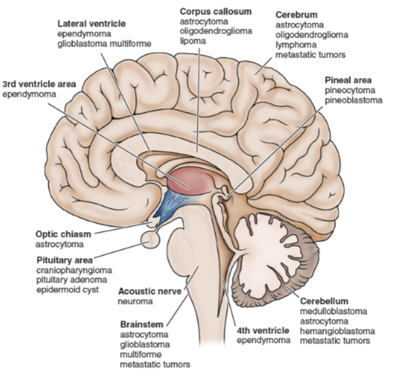 <ul><li><p>Neurologic examination</p></li><li><p>CT scan</p></li><li><p>MRI</p></li><li><p>PET scan</p></li><li><p>EEG</p></li><li><p>Cytologic study of cerebrospinal fluid</p></li><li><p>Biopsy</p></li></ul><p></p>