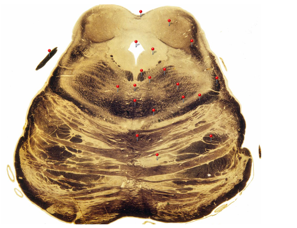 term image